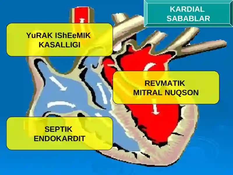 O‘tkir arterial tromboz va emboliyalar 4