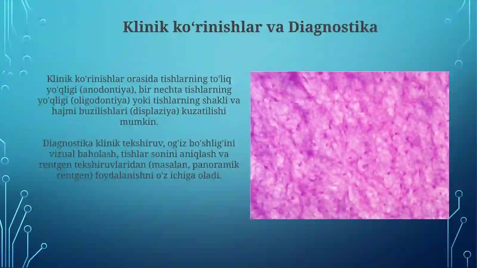Tugallanmagan odontogenez 4