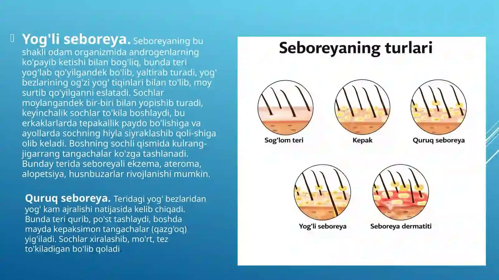 Seboreya.Pushti va oq rangli husnbuzarlar 4