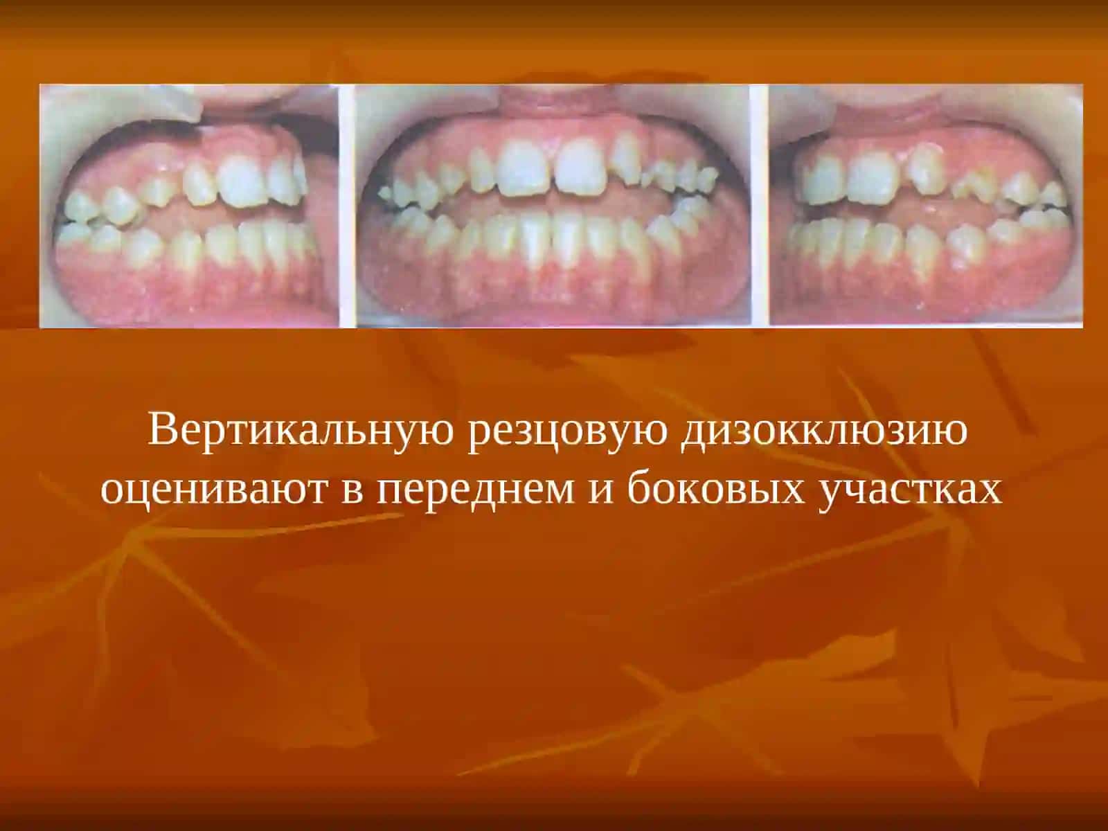ОТКРЫТЫЙ ПРИКУС 4