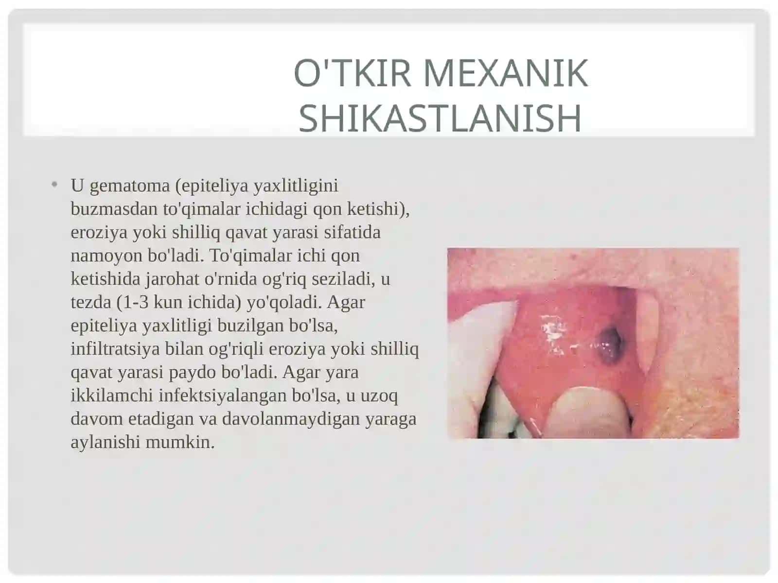 Og‘iz bo‘shlig‘i mexanik shikastlanishlari va ularning oldini olish choralari. 4