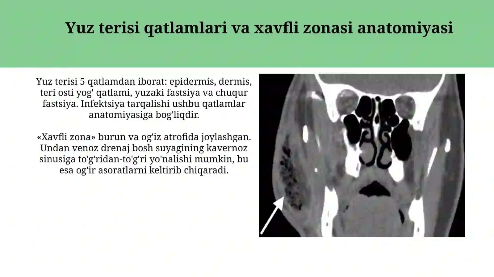 Yuzning yuza flegmonalarining ochish hamda drenejlashning klinik anatomik asoslari 4