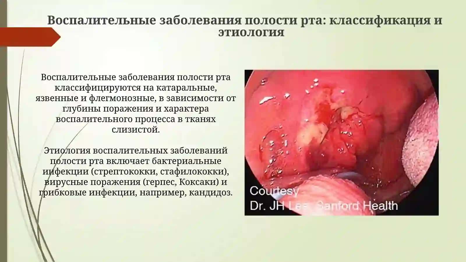 Воспалительные и опухолевые заболевания головы и шеи 4