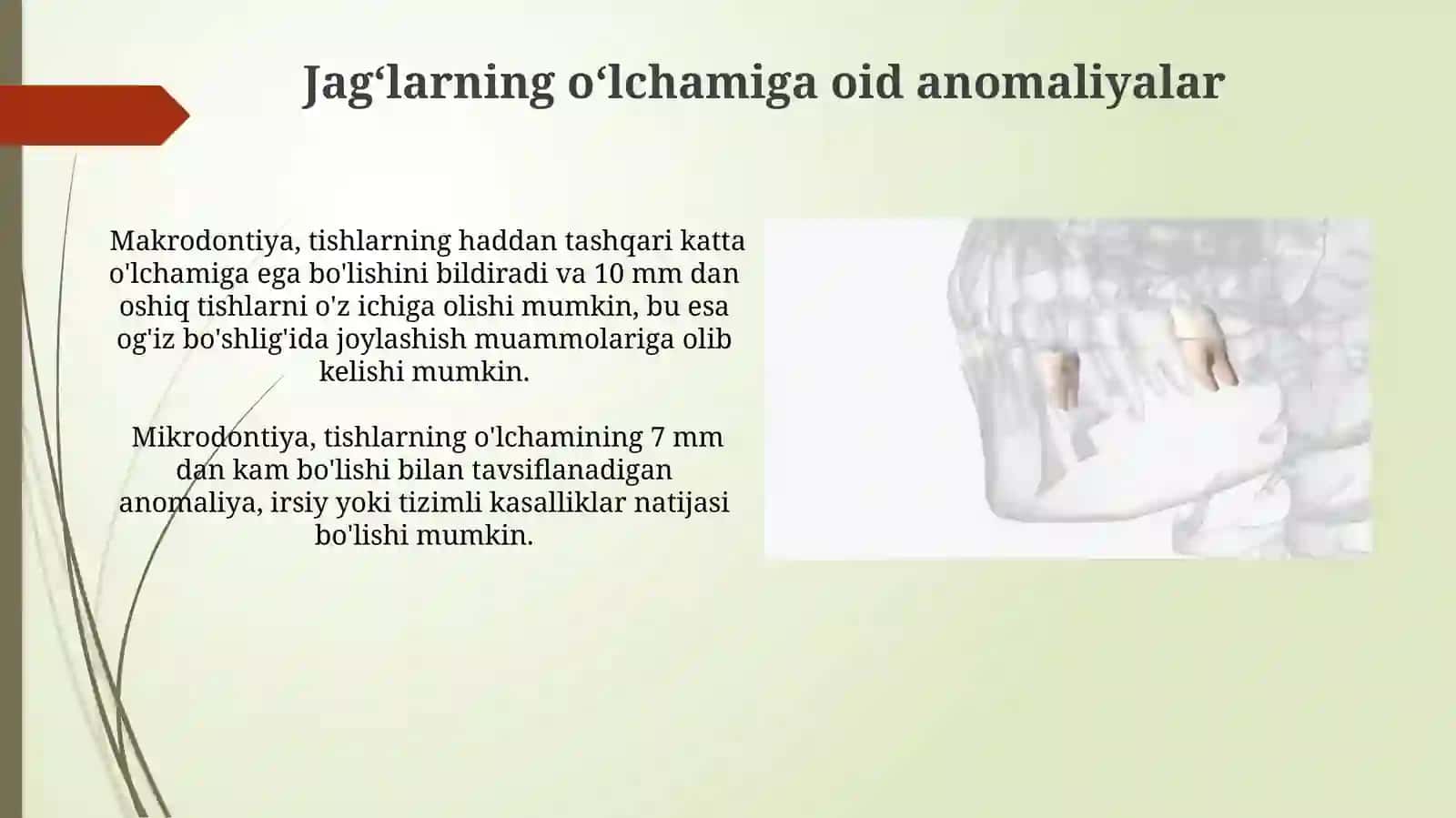 Tishlarning oʻlchamiga oid anomaliyalar 4