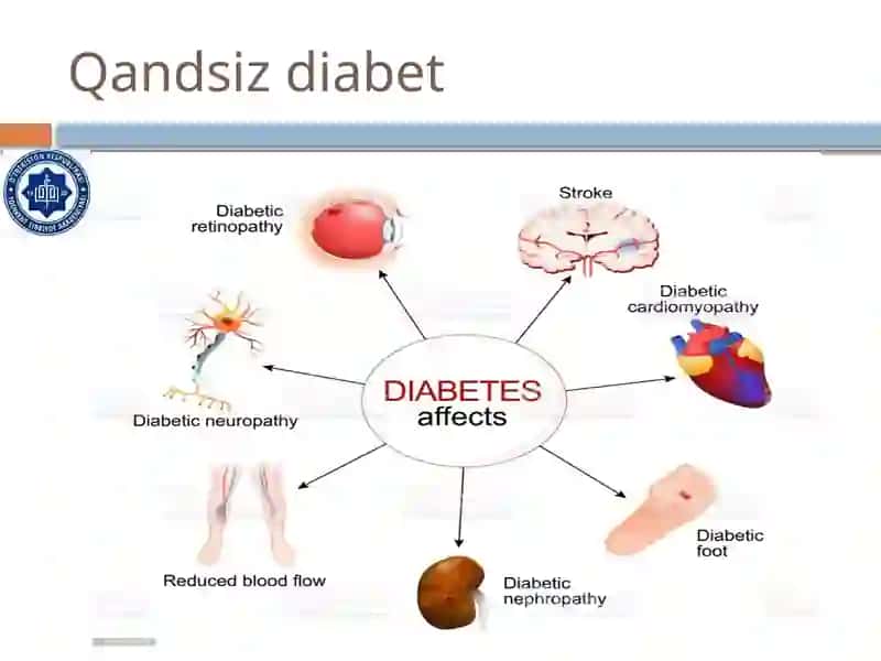 Qandsiz diabet 4
