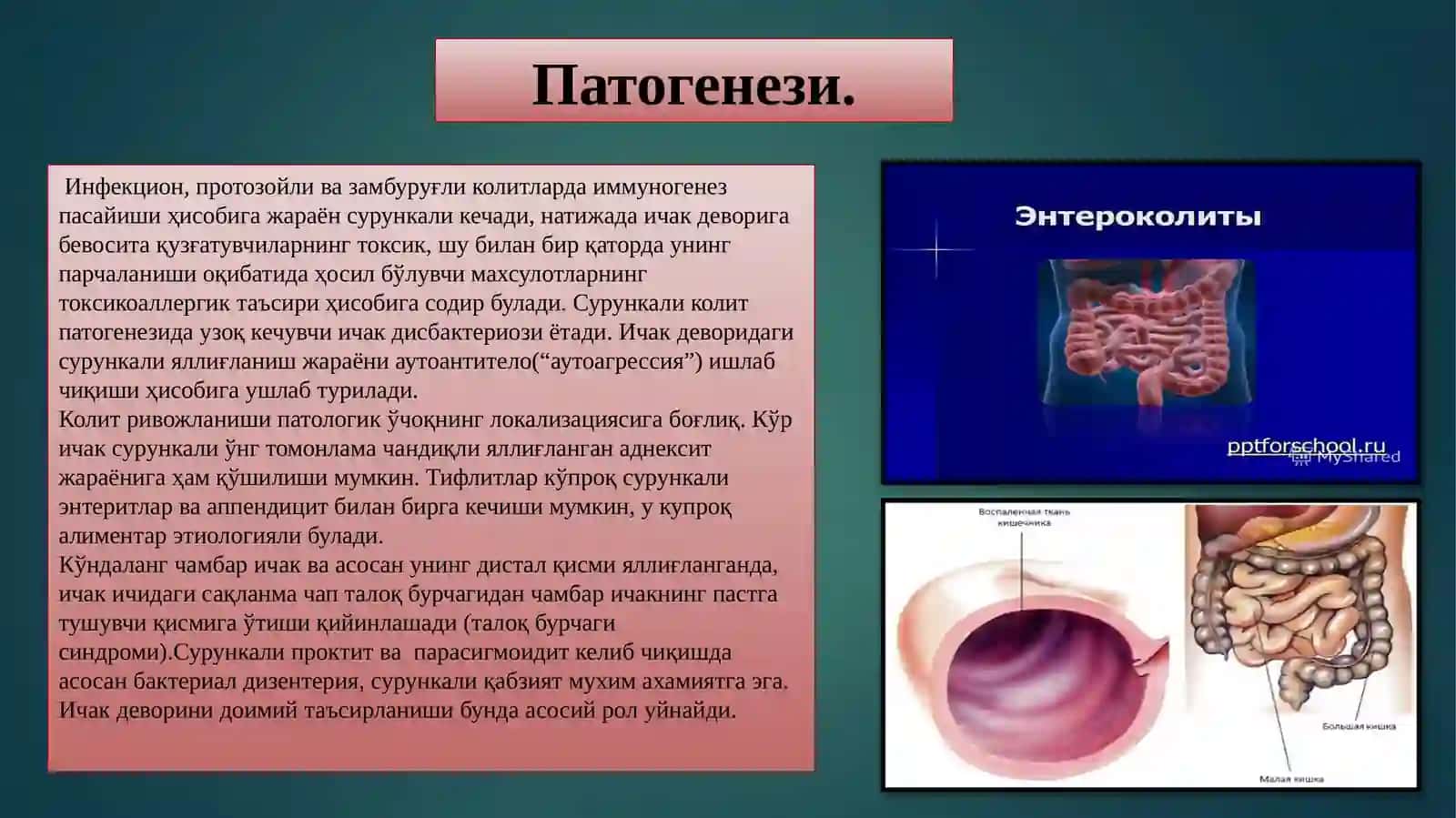 Surunkali Enterokolit;Etiologiyasi,Patogenizi,Klinikasi,Differinsial–Diagnostika,DavolashTamoillari… 4