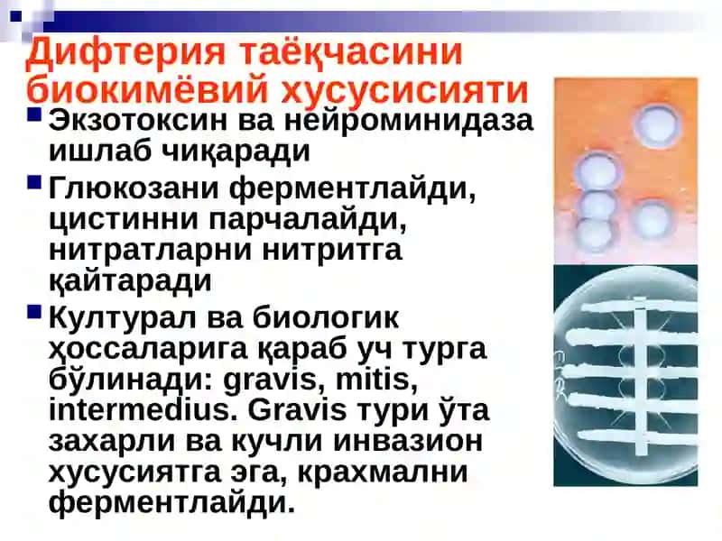 БЎҒМА – ДИФТЕРИЯ 4
