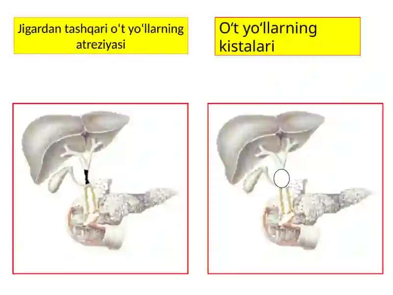 Mexanik  sariqlik 4