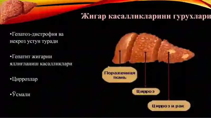 ГепатозГепатитВирусли гепатит 4
