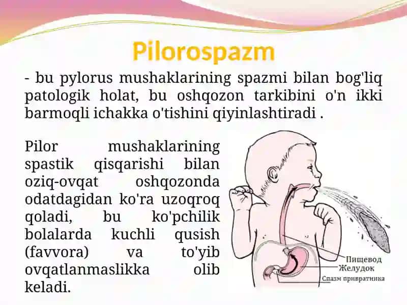 Pilorospazmva 4