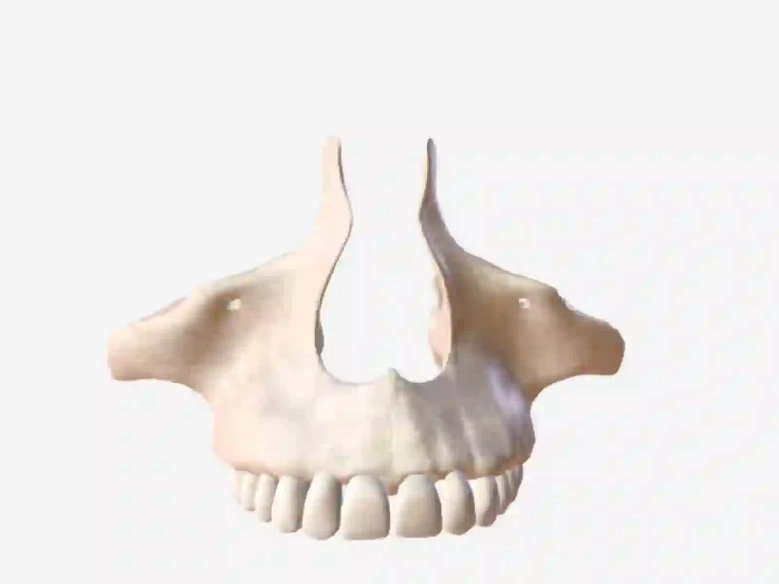 Osteologiya.Boshskeleti.Kallaningyuzqismi suyaklari 4