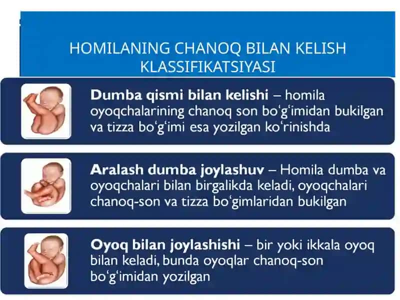 Homilaning chanoq bilan kelish holatlari 4