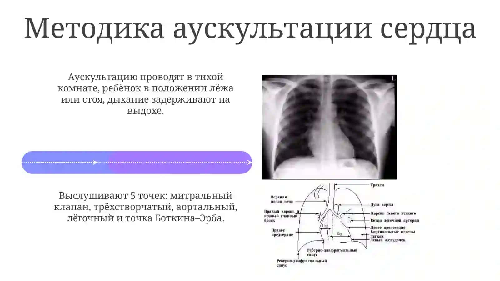 Аускультация сердца детей 4