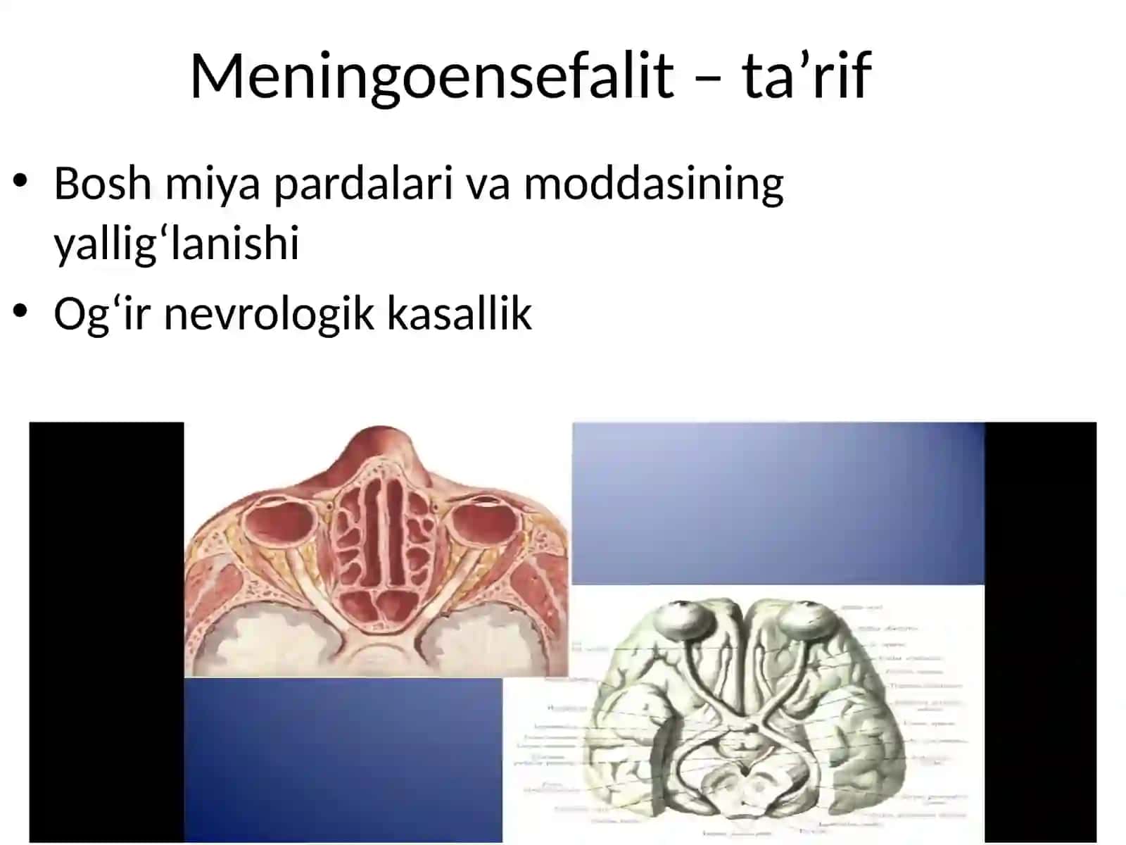 Nerv sistemasining infeksion-yallig‘lanish kasalliklari 4