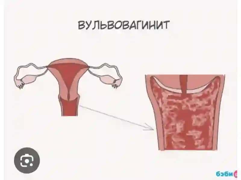 Jinsiya'zolarinospetsifikyallig'lanishkasalliklari 4