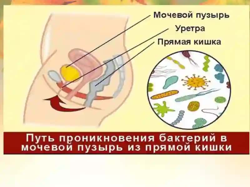 Siydik tanosil a’zolarining nospetsifik infeksion qo’zg’atuvchilari. 4