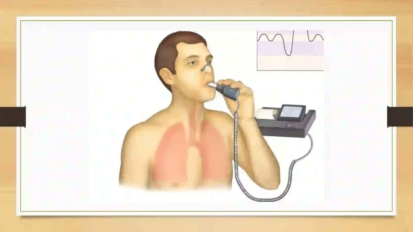 Nafas a’zolari kasalliklaridagi funksional- instrumental tekshiruvlar spirometriya, pnevmotoxometriya, oksigemometriya natijalarini interpertatsiyasi 4