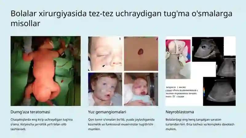 BOLALAR XIRURGIYASI FANIDAN MUSTAQIL ISHI 4