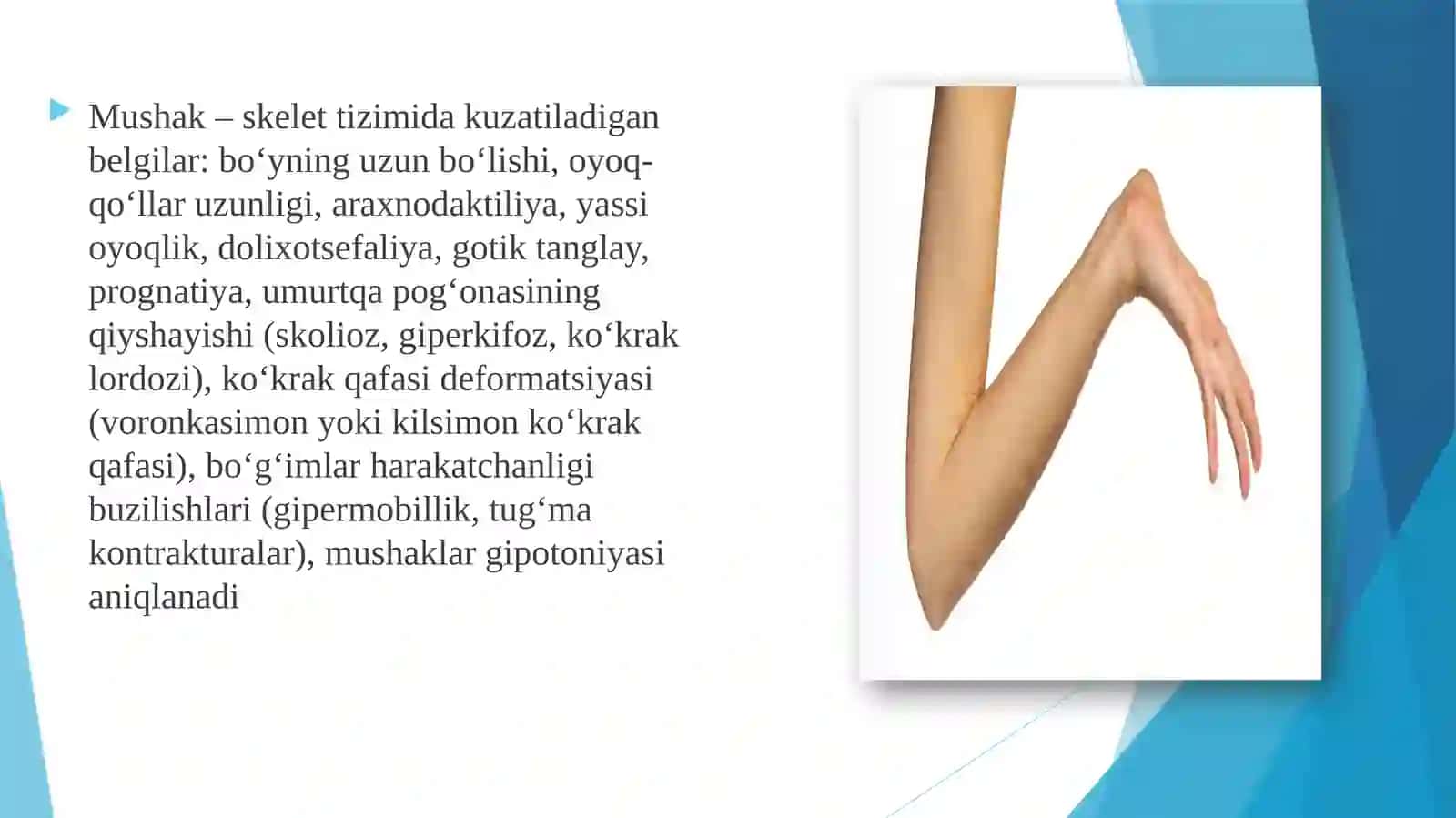 Marfan kasalligi.Oilaviy giperxolestirinemiya. 4