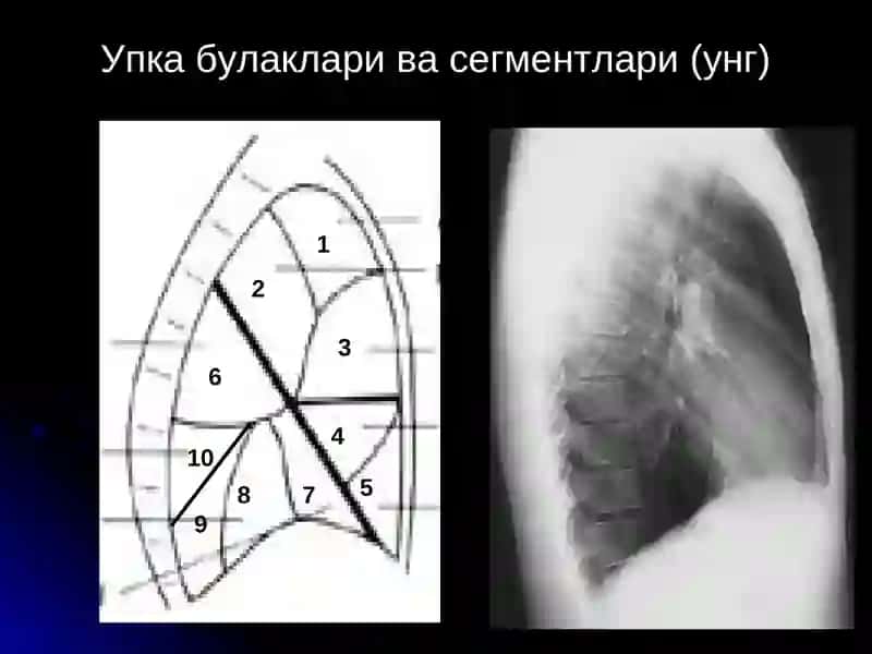 Ўпка касалликлари нур ташхиси 4
