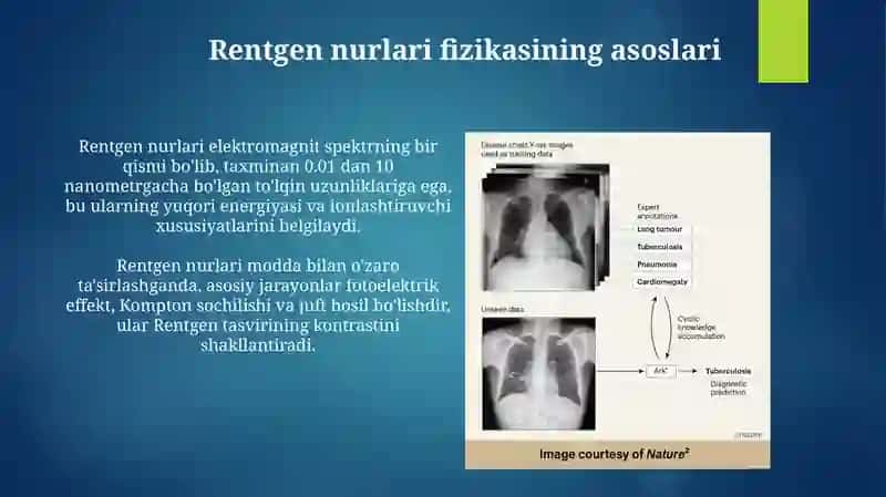 Rentgen nurlari: Asoslar, hosil bo'lishi va xususiyatlari 4