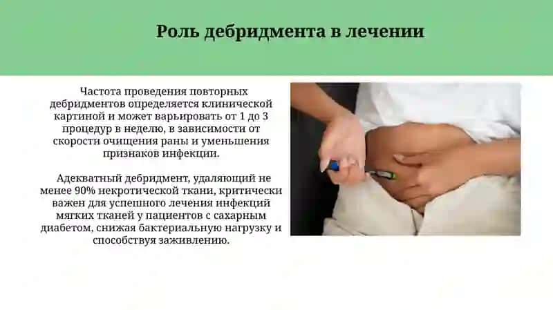 Методы лечения хирургических инфекций мягких тканей у больных сахарным диабетом 4