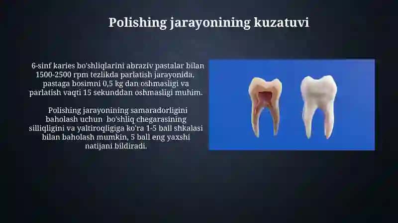 6-sinf karies kovaklarini charxlashning o'ziga xostomonlari 4