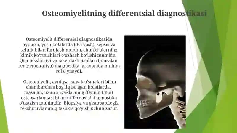 Osteomiyelit: ta'rifi va tasnifi 4