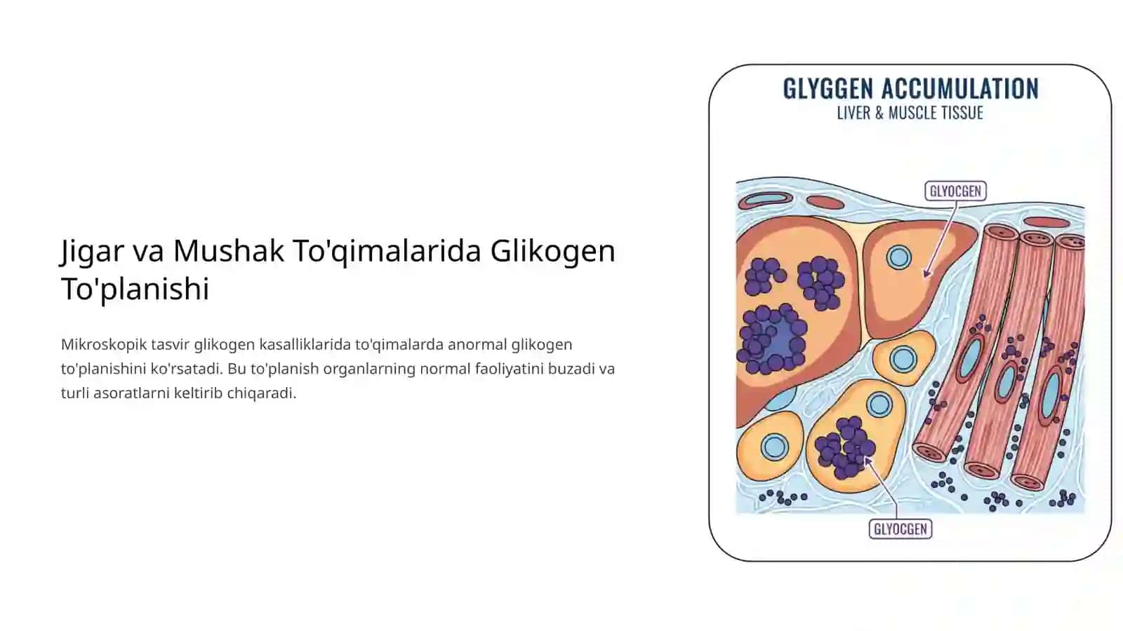 Glikogenkasalliklari 4
