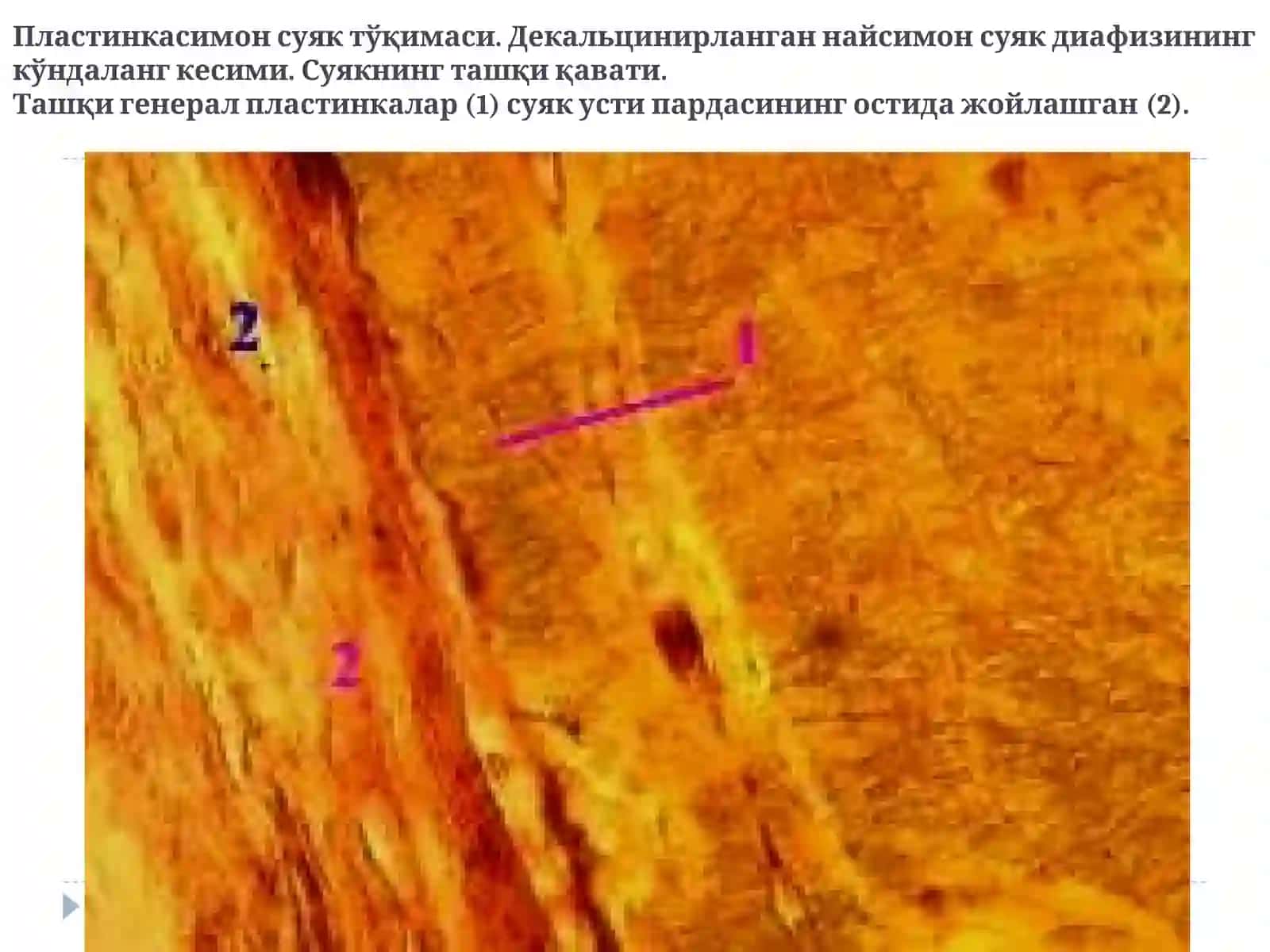СУЯК ТЎҚИМА 4