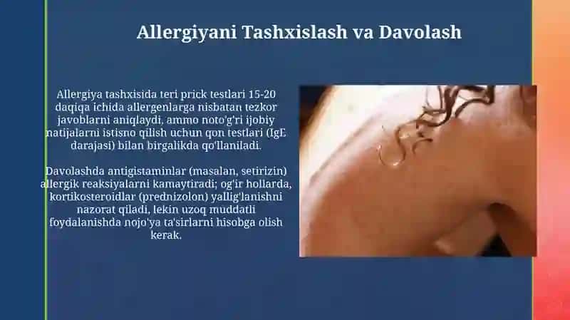 Allergiya 4