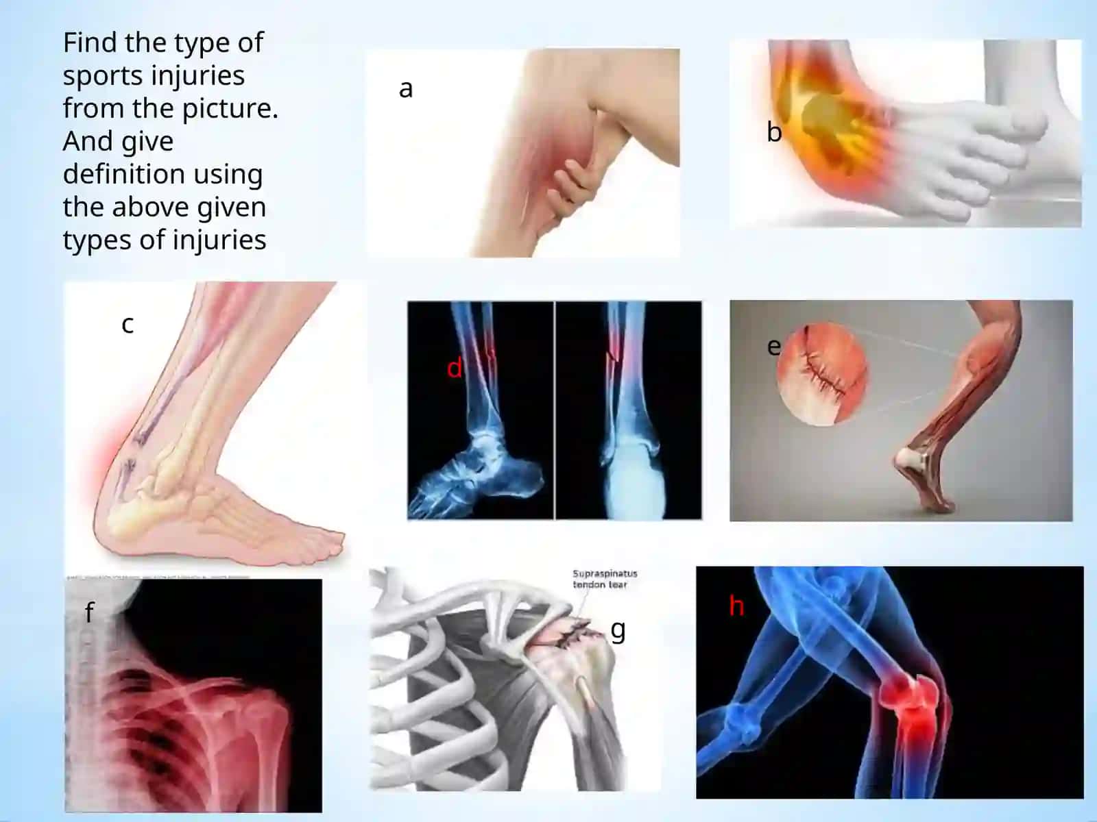 Sports medicine. Lesson 2.Signs andsypmtoms.Types of questions 4