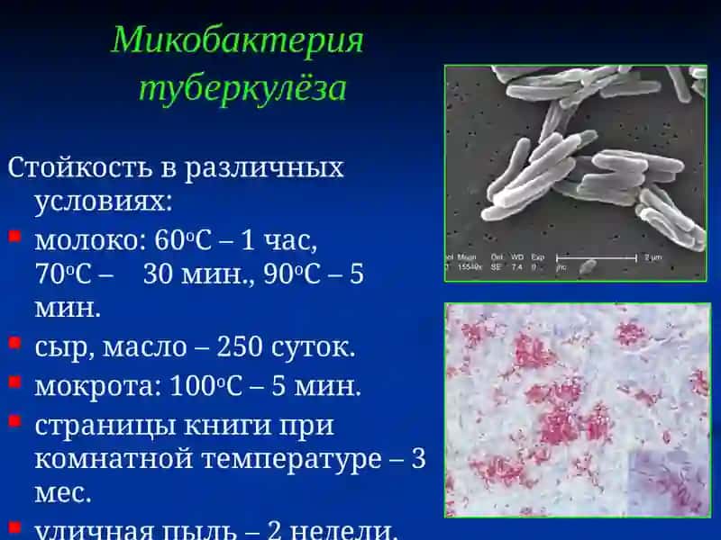 Туберкулёз. Воздушно-капельные инфекции 4