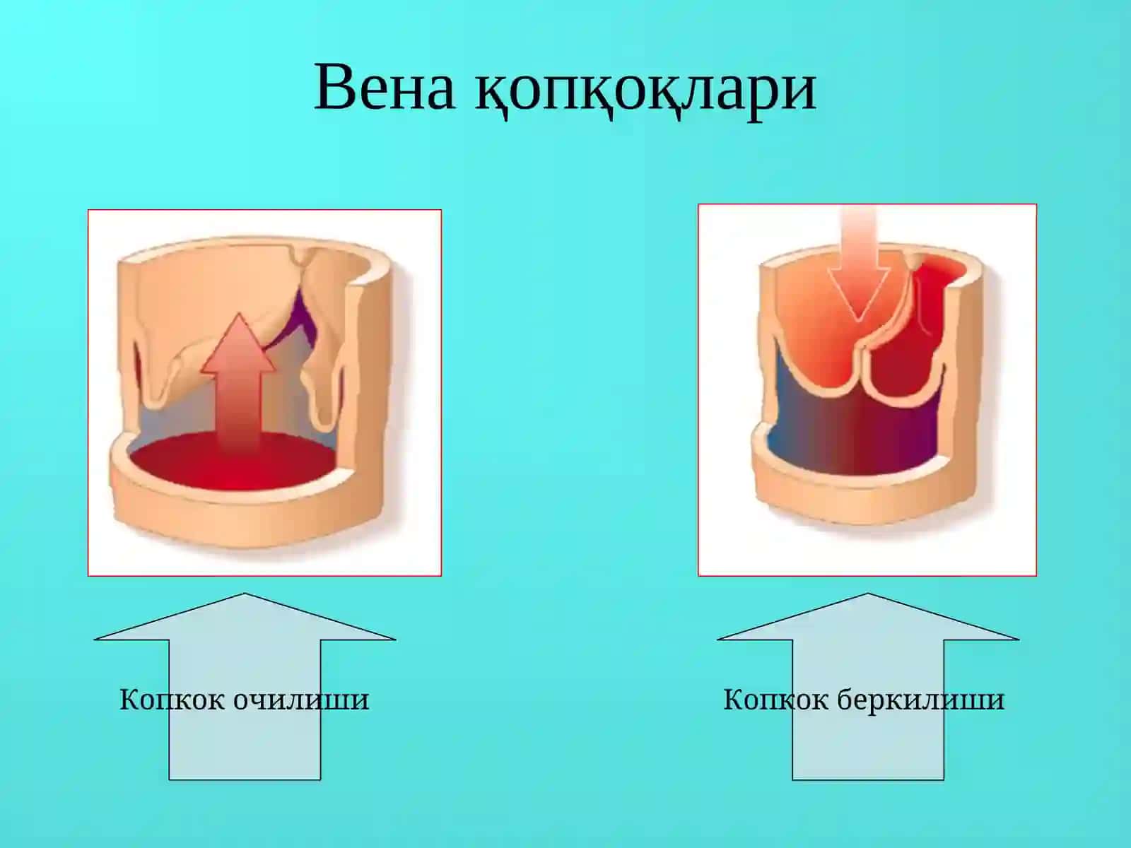 Оёқ веналарининг варикоз касаллиги 4
