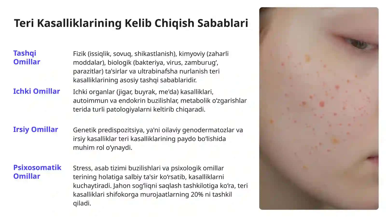 Teri kasalliklarini paydo boʻlishida ichki patologiyaning ahamiyati haqida umumiy maʼlumot 4
