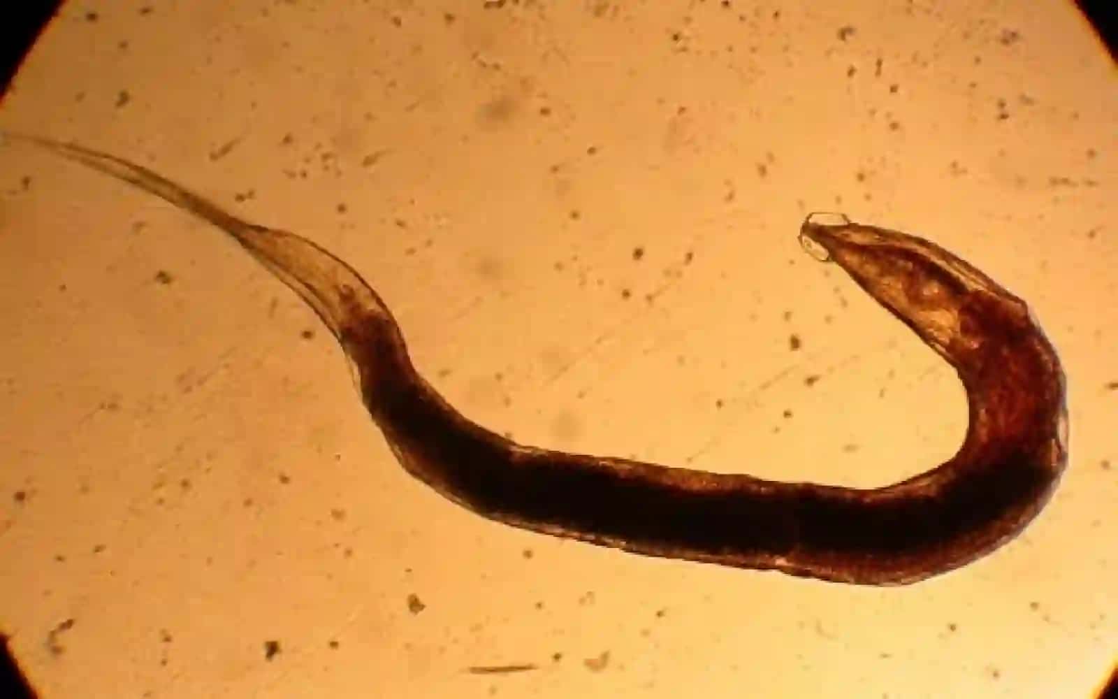 7-sinf Zoologiya 'Yassi chuvalchanglar tipi so'rg'ichlilar va tasmasimon chuvalchanglar sinflari' ko'rgazma 4