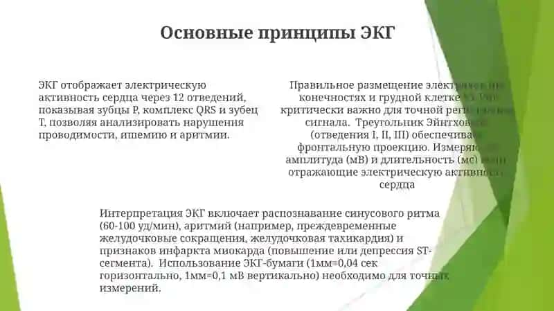 ЭКГ 4