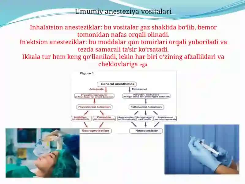 Zamonaviyanestetik vositalar 4