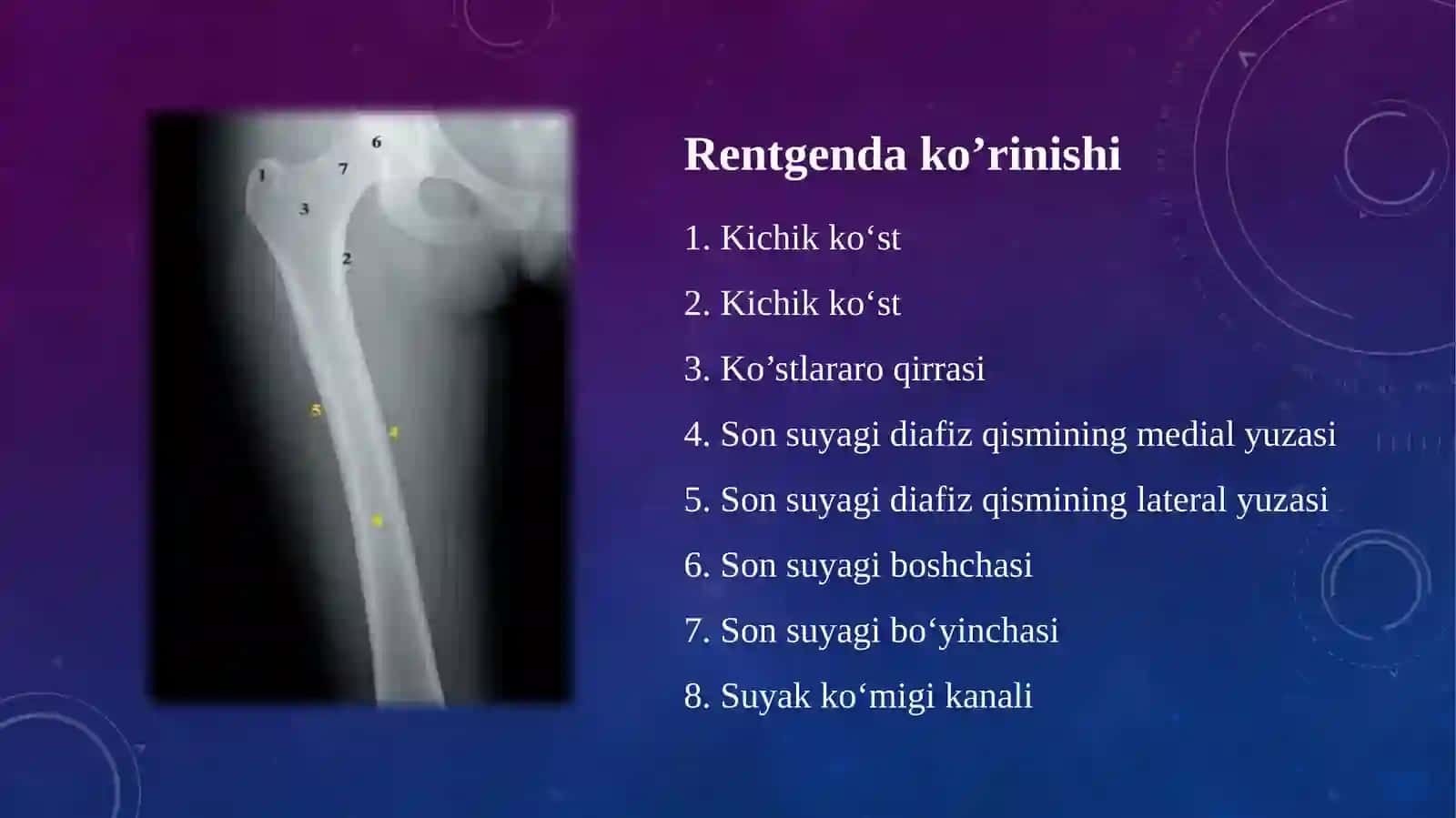 Son suyagi sinish va chiqishlari, ularning asoratlarI 4