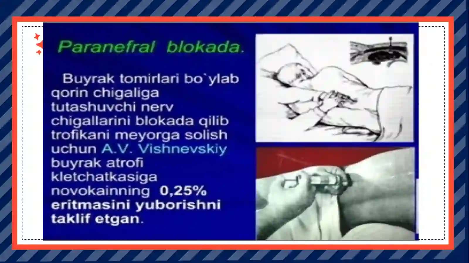 Bel sohasidagi operatsiyalar 4