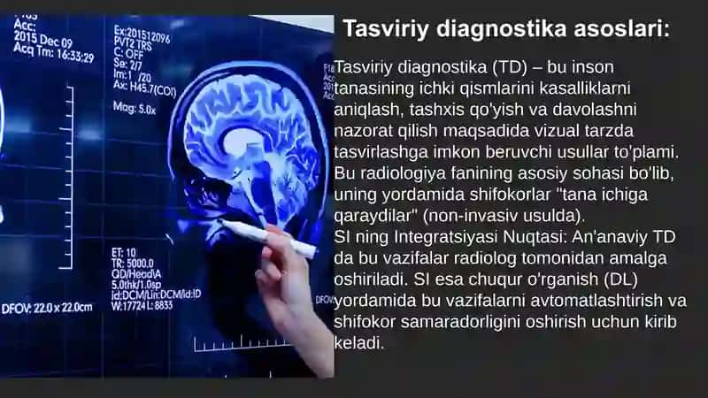 Sun'iy intellekt yordamida tasviriy diagnostika: Raqamli rentgen va MRT tahlili 4