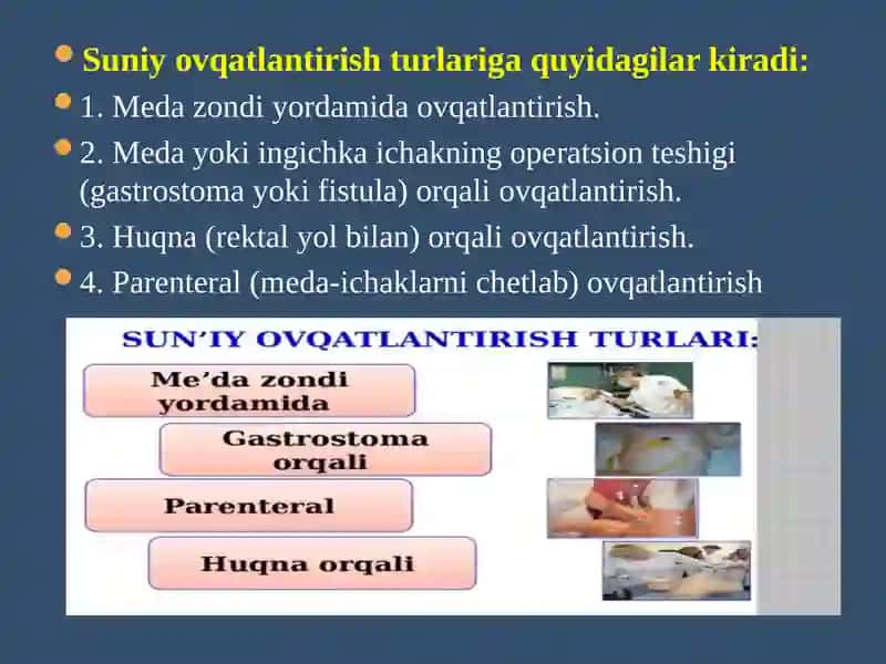 Sun’iy ovqatlantirishda bemorlarga hamshiralik parvarishi 4