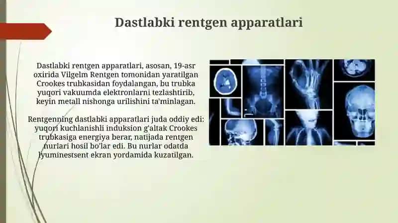 Rentgen nurlarini o'rganish tarixi suyak rengenlari rivojlanishini 4