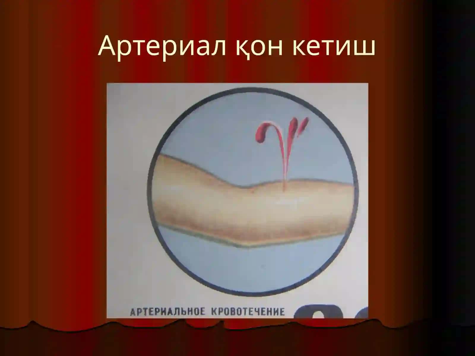 Қон кетиш ва уни тўхтатиш усуллари 4