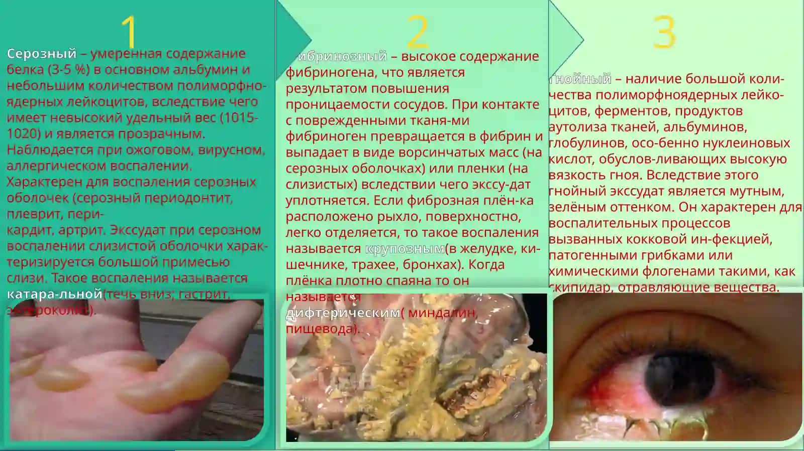 ПАТОФИЗИОЛОГИЯ 4