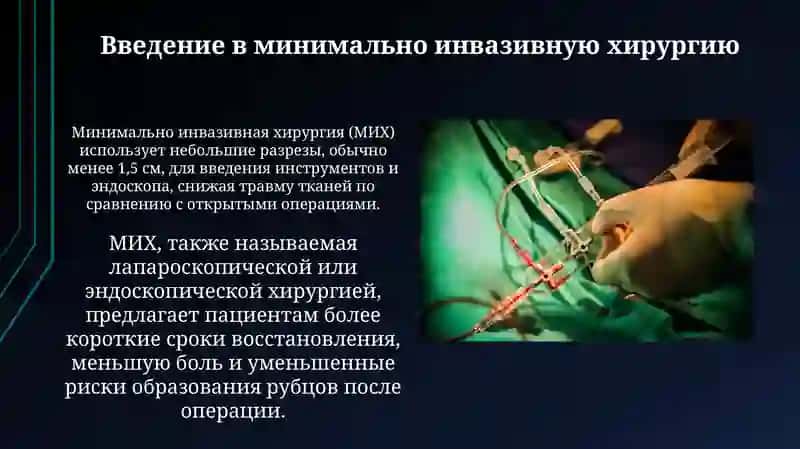 Принципы малоинвазивной хирургии и её вмешательства в хирургии 4