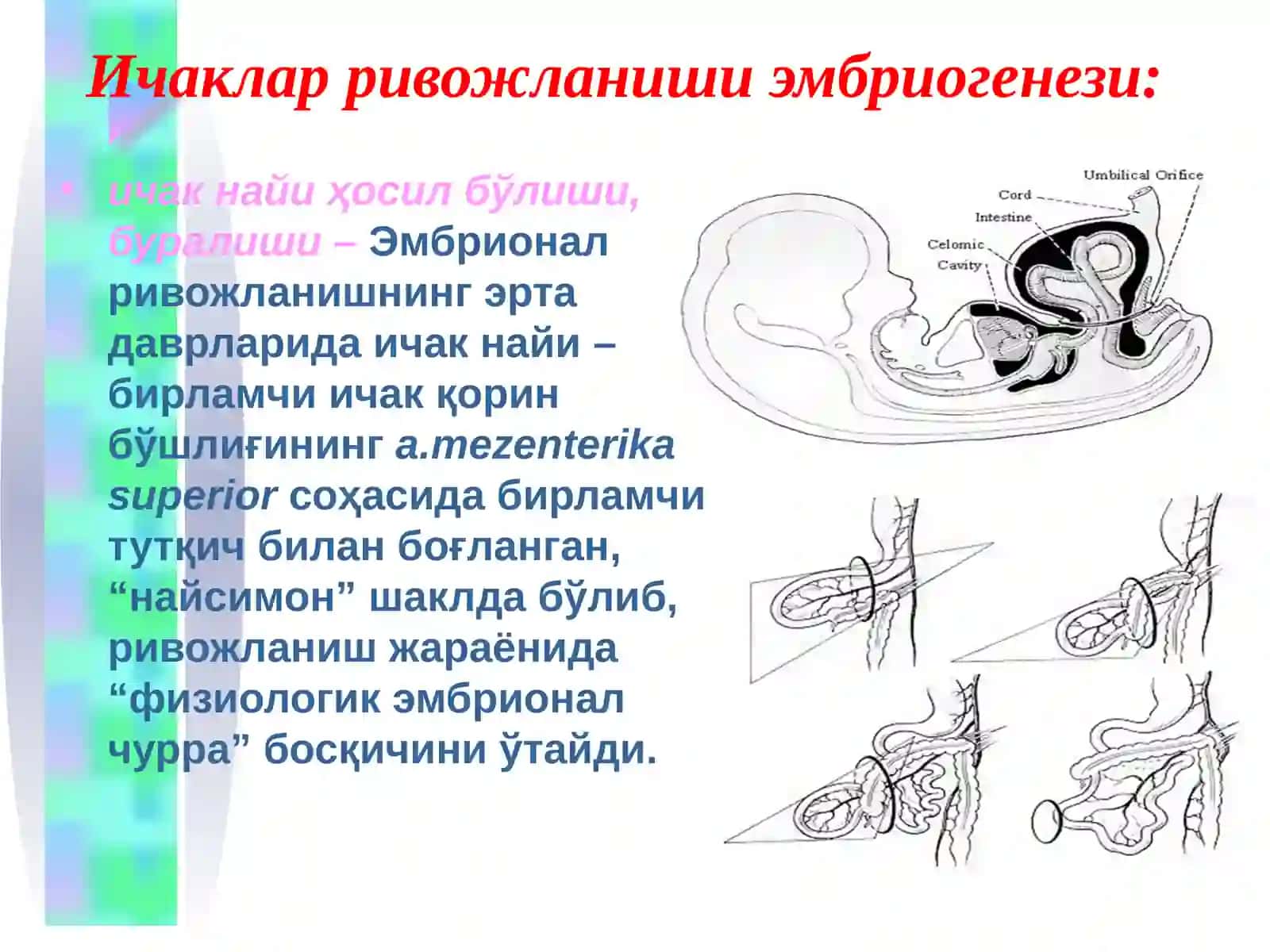 Ичак тутилиши 4