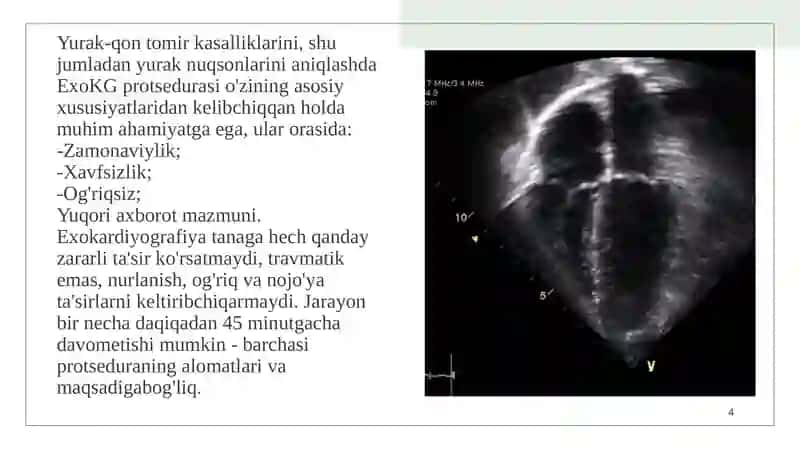 Exokardiografiya 4