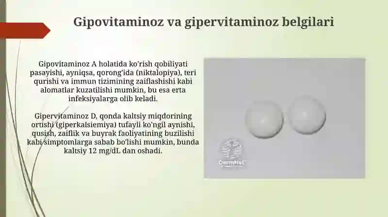 Gipovitaminoz va gipervitaminoz holatlarida moddalar almashinuvining buzilishi 4