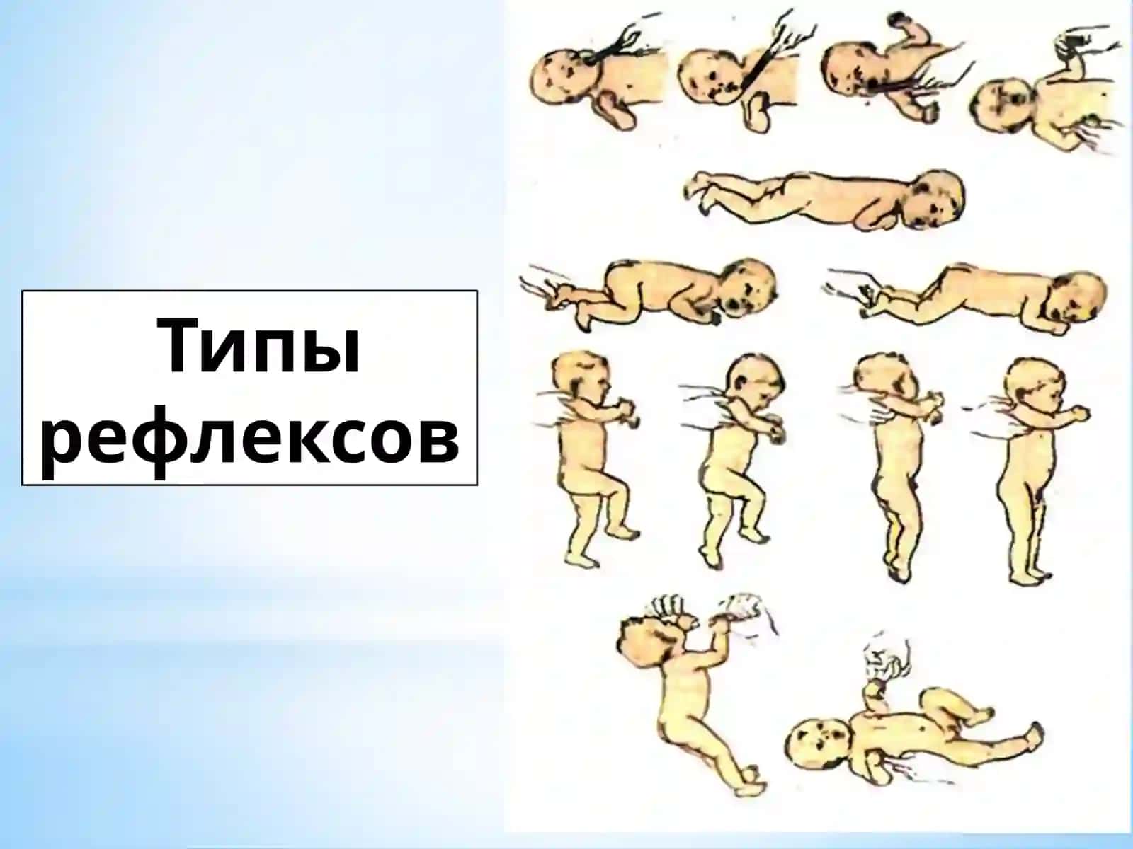 Развитие мозга. Оценка развития рефлекторных реакций у ребенка. 4